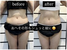 リメイクボディ センダイ(Re.Make Body SENDAI)/おへその形が縦にシュッとなった