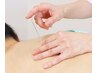 【背中/腰の痛みケア】全身鍼灸コース　60分