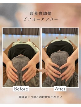 フェルナ 東新宿(FERNA)/脳脊髄液調整