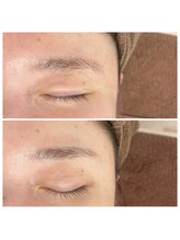 晴(haru)/ぽや眉さんもすっきり