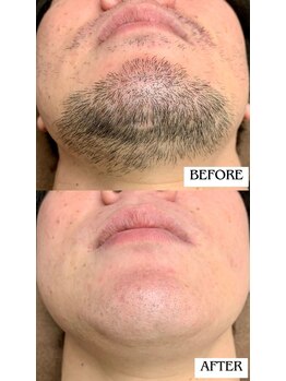 バディーズ(BUDDieS)/40代