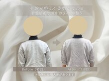 ステップ木更津鍼灸治療院/骨盤調整も姿勢ケアには必要です