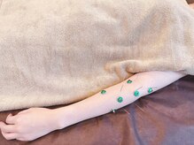 高田馬場はりきゅう院/腕の症状への鍼灸