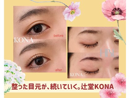 コナ(KONA)の写真