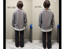 春日整体院ito/【姿勢改善ビフォーアフター】