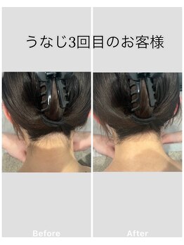 トッコ 清澄白河店(tocco)/うなじ脱毛