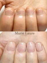 マリーロール 淀屋橋本店(Marie Laure)/自爪育成/深爪矯正/ネイルケア