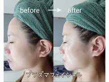 メルシー レディースアンドメンズサロン(Merci)の雰囲気（ツヤ肌を目指したい方はプラズマフェイシャルがオススメです。）