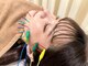 ことほぎ鍼灸整体 奈良登美ヶ丘院の写真/鍼+ドライヘッドスパ☆電気を流す美容鍼でリフトアップ♪ヘッドスパと組合せで効果UP！むくみ/眼精疲労も◎