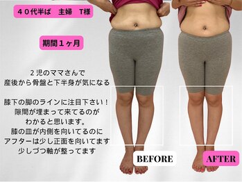 ビジリンヌ/ビフォーアフター1ヶ月