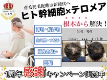 エルプラス(L+)