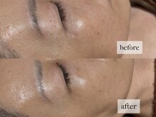 ヒナノ 矢場町店(HINANO)/フォーエバーヤング