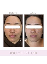 サロン アンジュ(salon.anju)/