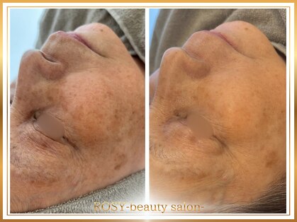 ロージー(ROSY)の写真