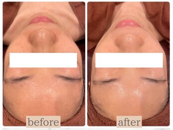 エステ ココ 荻窪店(Esthe CoCo)/美肌/肌管理/毛穴