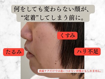 リボーン 柏(REBORN)/柏唯一“育てて整える”美肌ケア