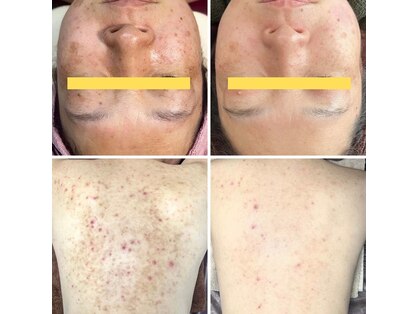 ボタニック 福津店(BoTANiC)の写真