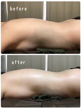ボディメイクサロン アクア(aqua)/身体が薄くなりました！