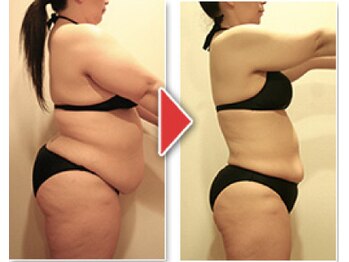 タルゴドゥエイチツーオー ホテル日航大阪店/ ビフォーアフター（上半身）