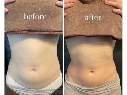 アレッタ(aletta.)の写真