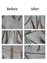 ニード(NEED)/頭皮のビフォーアフター