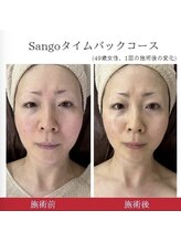 ウル(Ulu)/【スッキリ小顔＆たるみケア！】