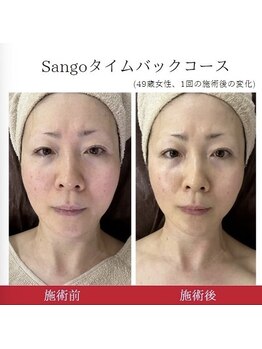 ウル(Ulu)/【スッキリ小顔＆たるみケア！】