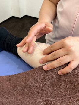 寺倉ハピネス接骨院の写真/【本格施術!】辛い首・肩コリ、腰痛にお悩みの方必見◇原因は体の歪みかも!?姿勢を整えて根本から徹底改善!