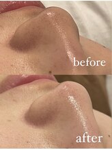 チル(chill)/ビフォーアフター