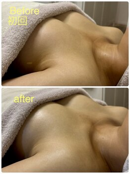 ベッピン(Beppin)/バストハリUP/ボリュームUP