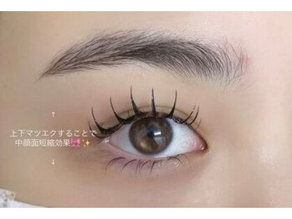 フランク(Frank)の写真