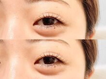 リハ(RIHA..)/目の形,まつ毛,悩みに合わせ施術