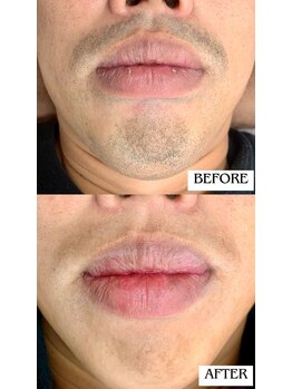 バディーズ(BUDDieS)/30代