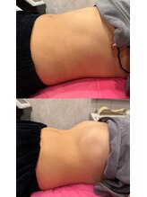 ブリア 横浜(BRILLA)/1回で見た目の変化が分かる