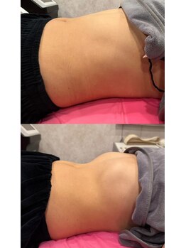 ブリア 横浜(BRILLA)/1回で見た目の変化が分かる