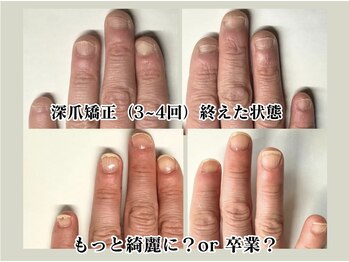 クウ(KUU)/もっと綺麗に?それとも卒業?