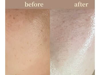 ユーアンドハニー(U&Honey.)/酵素の力で透明感あふれるツヤ肌