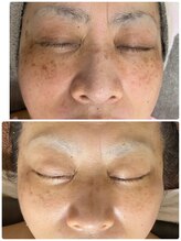 小顔専門サロン ラリューシュ(La ruche)/静岡駅南口から徒歩２分！