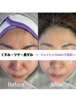 ベリンダ ワックス(BELINDA WAX)/フェイシャルWAXは美肌への近道