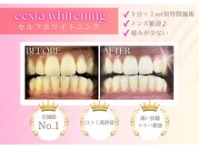 エクシアホワイトニング 五反田店/セルフホワイトニング/五反田