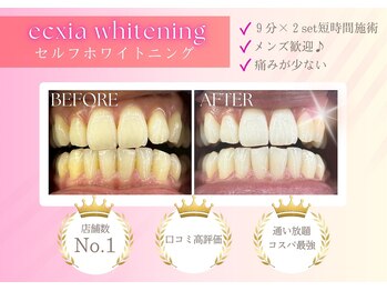 エクシアホワイトニング 五反田店/セルフホワイトニング/五反田