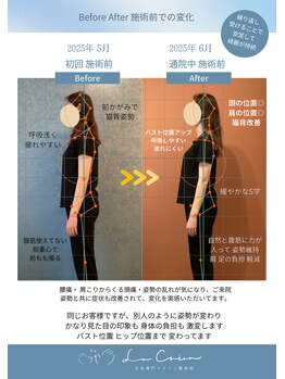 ラクリエ 姫路駅前院(La Creer)/施術ビフォーアフター/猫背/肩