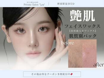 レア(Lea)の写真/結果重視の毛穴専門サロン♪【毛穴悩み、くすみ、ザラつき】を毛穴洗浄・フェイスワックスで徹底ケア◎