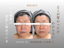 ジュジュ(juju)/１回で終わるの勿体ない