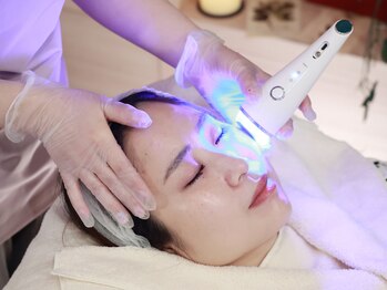 ミエリア美容鍼灸院(mielia美容鍼灸院)/7.温冷機器で引き締める