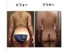 【むくみ徹底改善】 筋膜&最強デトックス 90分¥22,000→¥16,500→¥15,000