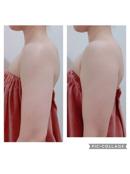リレア(relair)/上半身スッキリで二の腕まで細く