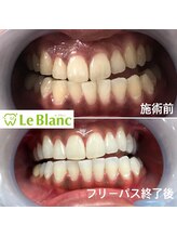 ルブラン 奈良店(Le Blanc)/1回700円！？