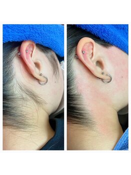 サロンアンドスクール ローズマリー (Salon&School Rosemary)/えりあしが綺麗(うなじもみ首)