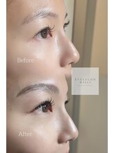 ミリ(Milli)/アンドヘルシー＋130本フラット